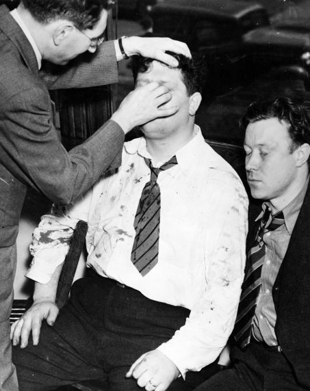 A blood-soaked Richard Frankensteen has his wounds attended to after being beaten by Ford Service Department employees during the Battle of the Overpass. Walter Reuther sits at right, his eyes closed.